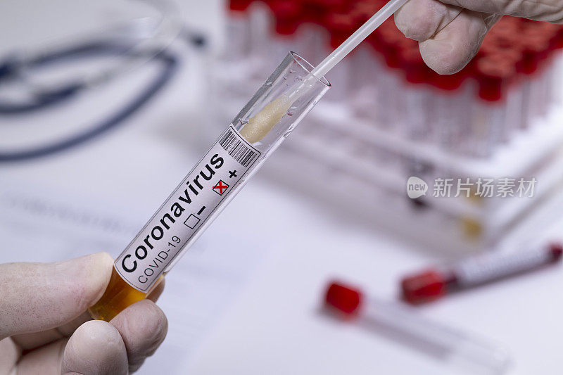 新型冠状病毒COVID - 19检测新型冠状病毒医护人员检测样本